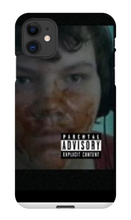 allfatnoskinny iPhone Phone Cases