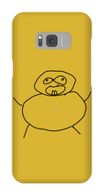 Obesity Samsung Phone Cases
