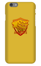 massiveontv iPhone Phone Cases
