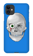 yuriyzakk iPhone Phone Cases | Skull
