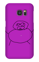 Obesity Samsung Phone Cases