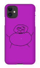 Obesity iPhone Phone Cases