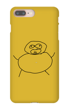 Obesity iPhone Phone Cases