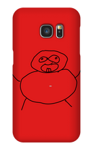 Obesity Samsung Phone Cases