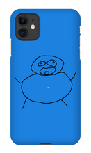 Obesity iPhone Phone Cases