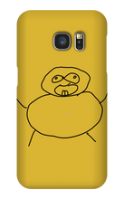 Obesity Samsung Phone Cases