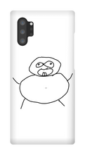 Obesity Samsung Phone Cases