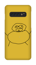 Obesity Samsung Phone Cases