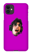 its my face on a Iphone case