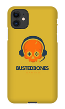 Busted Bones iPhone Case (Light)