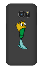 prothesenking Samsung Phone Cases