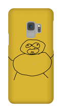 Obesity Samsung Phone Cases