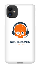 Busted Bones iPhone Case (Light)