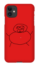 Obesity iPhone Phone Cases