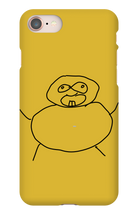 Obesity iPhone Phone Cases