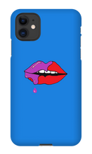 Johan Lip iPhone Case
