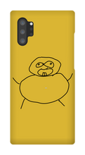 Obesity Samsung Phone Cases