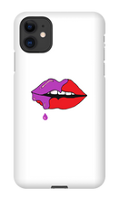 Johan Lip iPhone Case