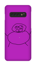 Obesity Samsung Phone Cases