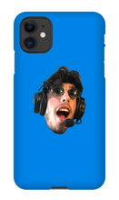 its my face on a Iphone case