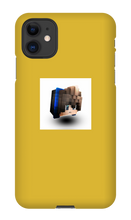 mrdiploben iPhone Cases (Profile Pic!)