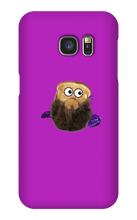 toastaxz Samsung Phone Cases