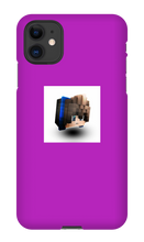 mrdiploben iPhone Cases (Profile Pic!)