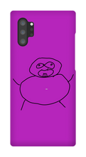 Obesity Samsung Phone Cases