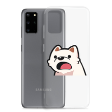DarkViperAU D Samsung Case